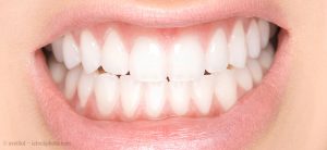 Zahnschmelz - Schutzmauer unserer Zähne